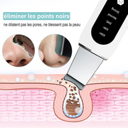 STELLAR - Exfoliant Lifting EMS  5 fonctions  - Soin à ultrasons & photons-8