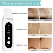 STELLAR - Exfoliant Lifting EMS  5 fonctions  - Soin à ultrasons & photons-10